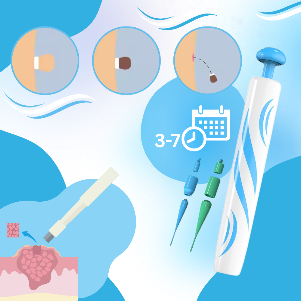 Skin Tag Removal Pro - Ozerty