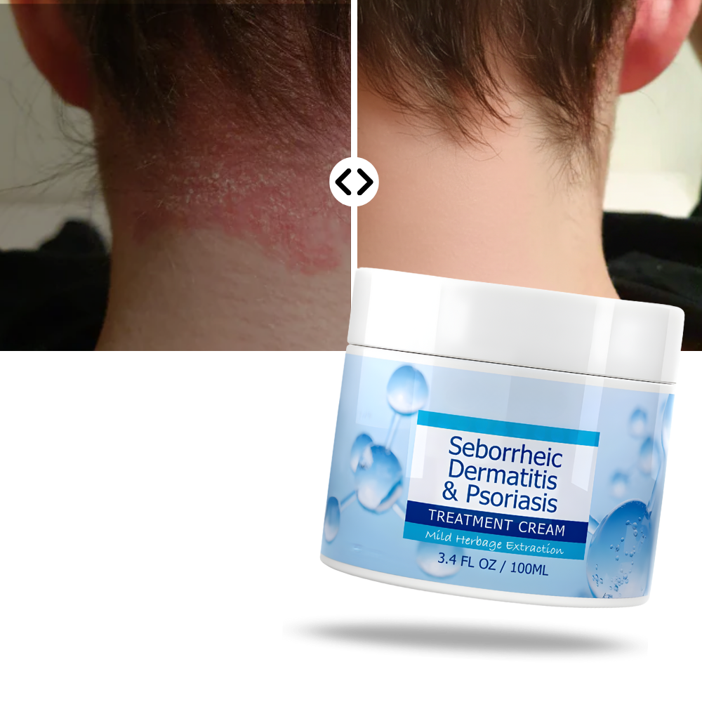 Scalp Care Hydrating Cream - Ozerty