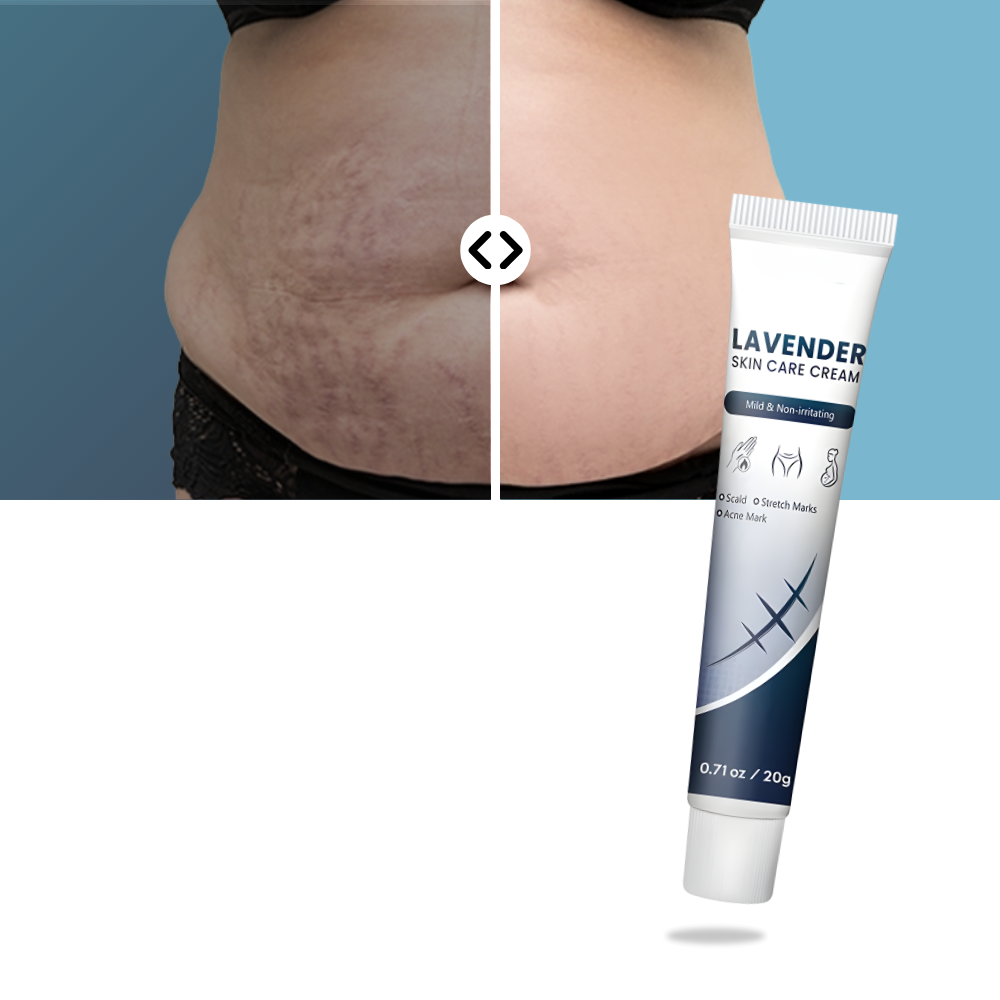 Scar Hydrating Silicone Cream - Ozerty