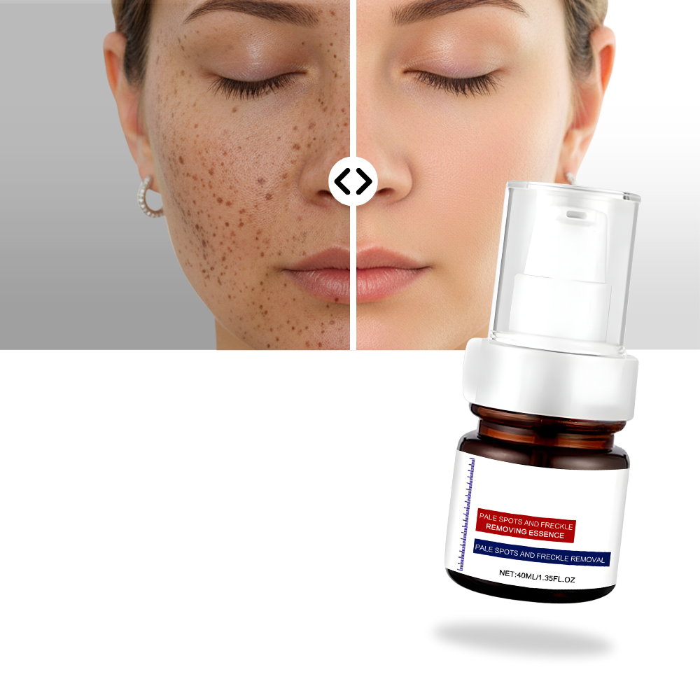 Skin Brightening Silky Kojic Serum  - Ozerty