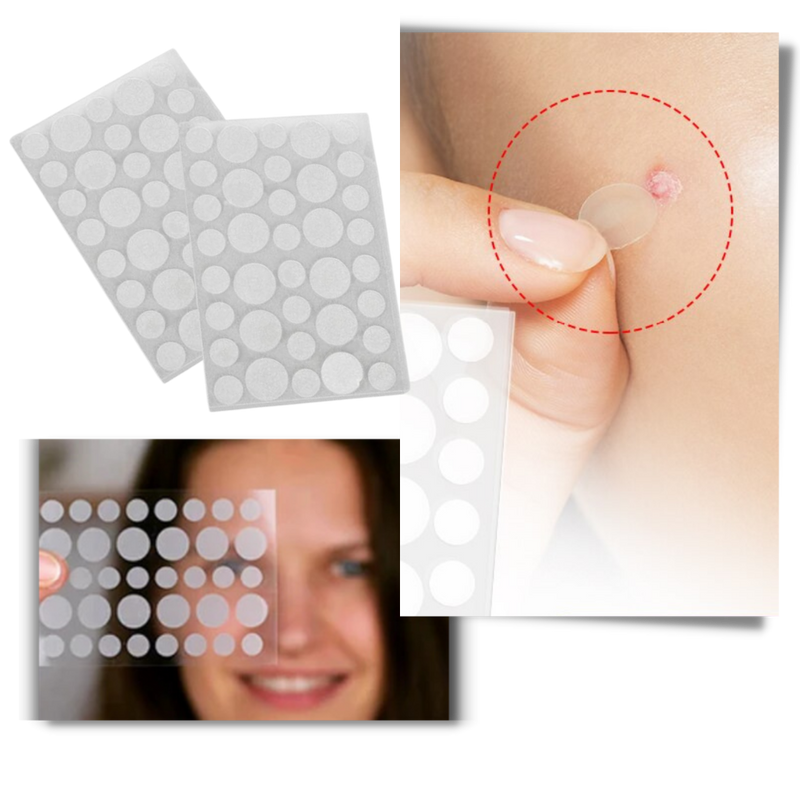 36-Pack Invisible Acne Patches