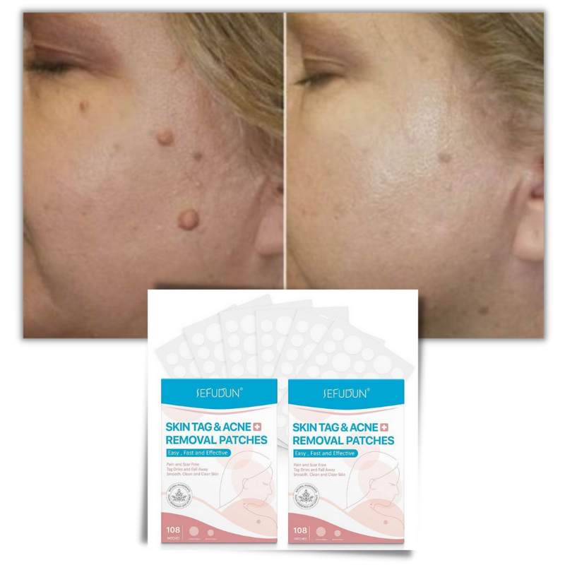 Skin tag removal treatment patch