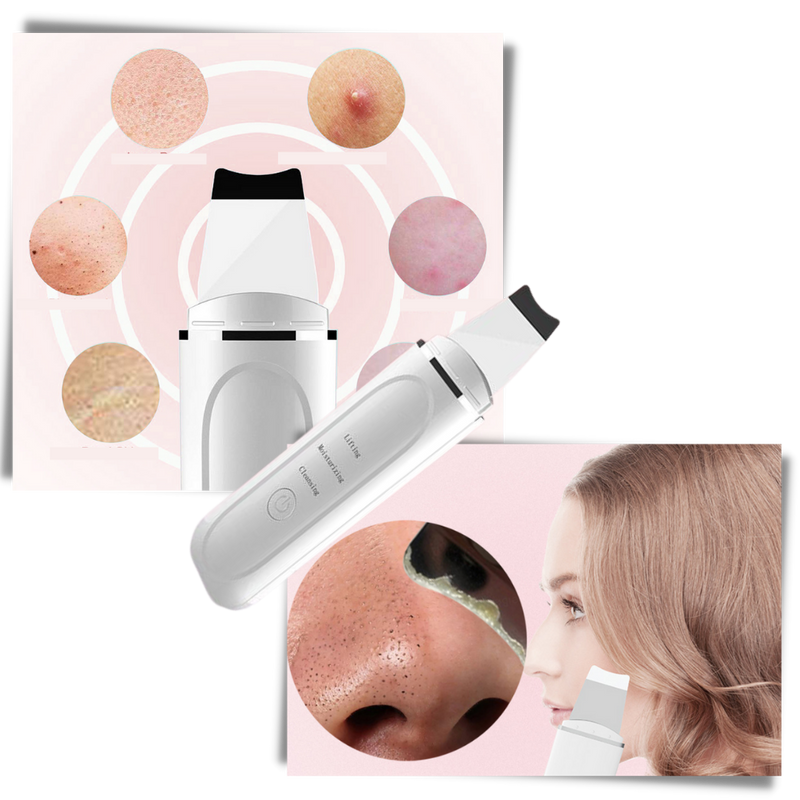 Ultrasonic deep cleansing facial scrubber