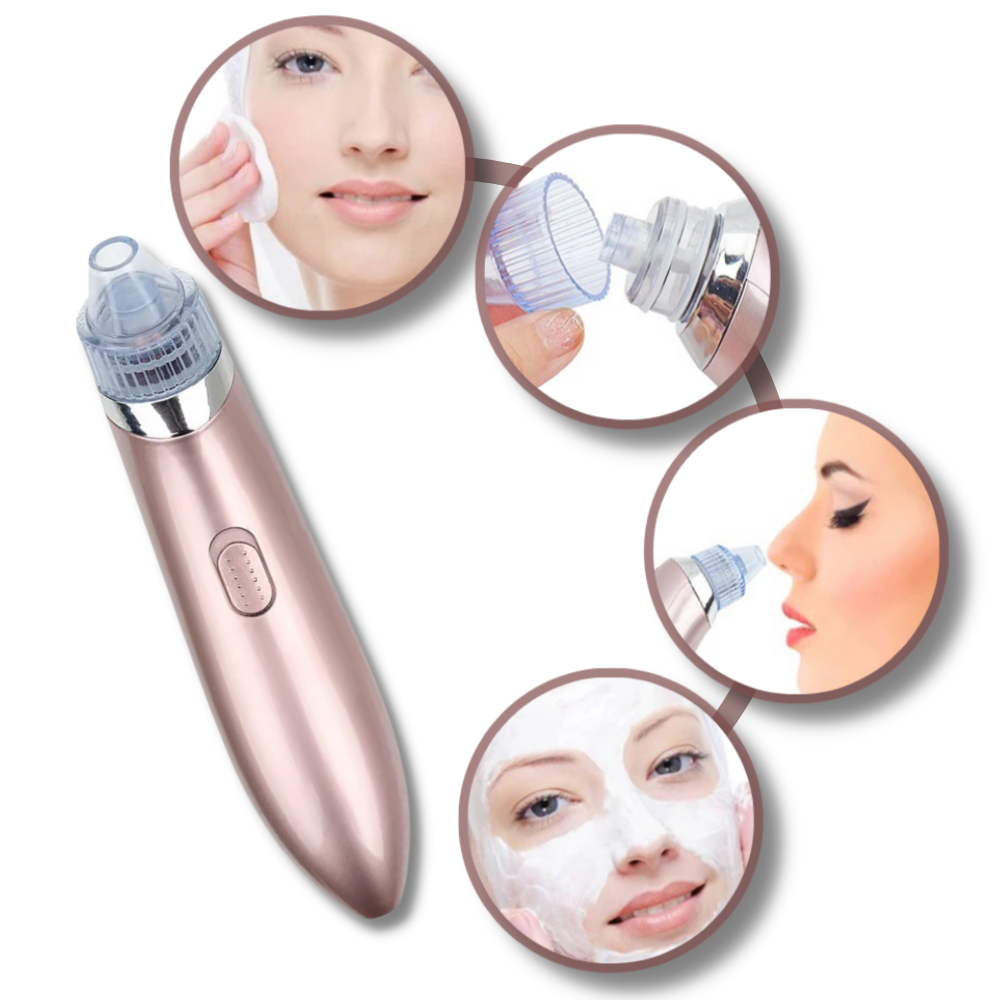 Facial Blackhead Remover Set - Ozerty