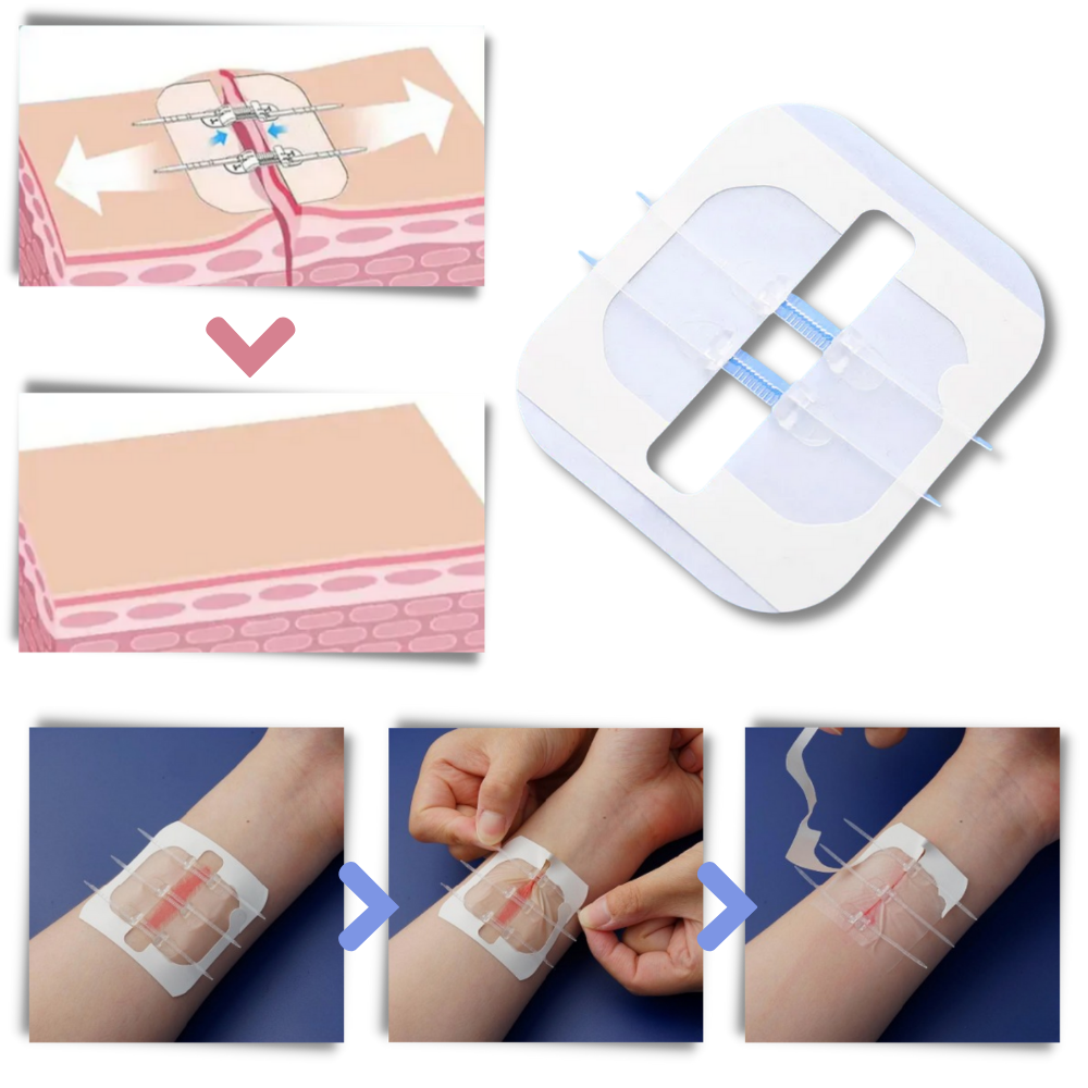 Water-proof wound adhesive - Ozerty